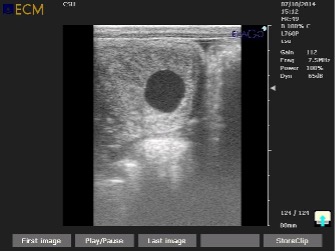 Pregnancy Management